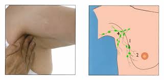 1), then follow in order finishing just above the collarbone (no. British Association Of Dermatologists Patient Information Leaflets Pils