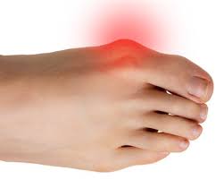 Lateral foot pain is pain that runs along the outer side of the foot and ankle. Pain On Outside Of Foot Causes Symptoms Treatment