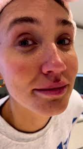 Are you a skinny burger or a full fat???? Full recipe in my GF cookbook  ‘can you make that gluten free’ 🍔🥬 #glutenfree #fyp