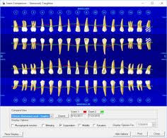 55 best clinical charting images dental charting dental