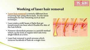 Hair growth from grafted donor site. All About Laser Hair Removal Informatie360