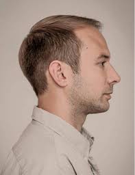 Fret not, you can make your receding hairline work for you by sporting one of the stylish hairstyles for balding men. 50 Classy Haircuts And Hairstyles For Balding Men