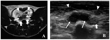 Diagnostics Free Full Text Anatomy And Imaging Of Rat Prostate Practical Monitoring In Experimental Cancer Induced Protocols Html