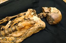 Why did otzi the iceman have so many tattoos? The Tattoos Of Otzi The Iceman Medicinal Or Symbolic National Museum Publications