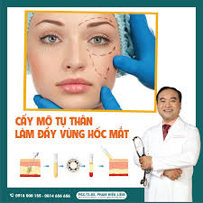 CẤY MỠ TỰ THÂN