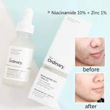 Consistent use maintains clear, calm and energetic complexion. Ready Stock The Ordinary Niacinamide 10 Zinc 1 High Strength Vitamin And Mineral Blemish Shopee Malaysia