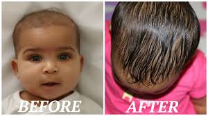 Rate of hair growth is about 1.25 cm per month on an average. How To Grow Your Babies Hair Back Fast Youtube