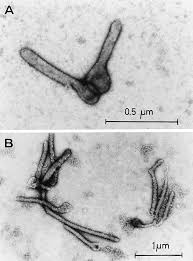 Marburg virus was first recognized in 1967, when outbreaks of hemorrhagic fever the reservoir host of marburg virus is the african fruit bat, rousettus aegyptiacus. A B Electron Microscopic Appearance Of Marburg Virus Stained By Download Scientific Diagram