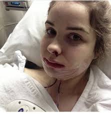 23 and I Want a Nice Smile!