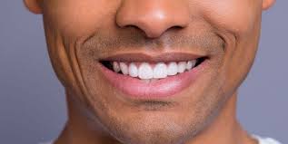 But how do you go about brightening up your teeth naturally, without the filters or veneers? Teeth Whitening Is It Safe And Which At Home Kits Work