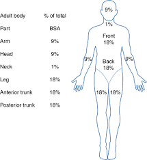 Burn Injury Rule Of Nines Springerlink
