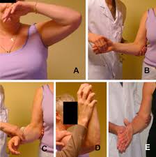 Image result for Yergason Test