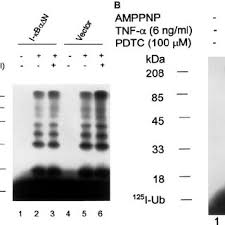 View the profiles of people named ian waddell. Ian Waddell Head Of Bilogy Drug Discovery Bsc Phd The University Of Manchester Manchester Paterson Institute For Cancer Research