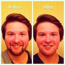 Before and after #noshavenovember