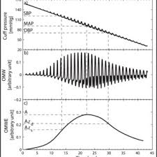An anxious patient must be calmed by blood pressure can be measured in supine, seated and standing positions. Oscillometry System Physical Setup The Intraarterial Bp And The Cuff Download Scientific Diagram