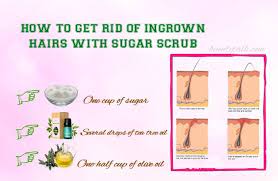 Do You Know How To Get Rid Of Ingrown Hairs Fast Naturally This Is What You Need To Know Ingrown Hair Get Rid Of Ingrown Hairs Ingrown Hair Bikini
