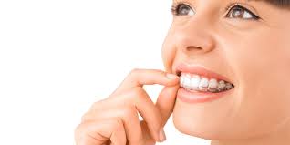 Check spelling or type a new query. Invisalign No Brace System Straighten Your Teeth Quality Results
