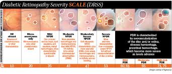 Anti Vegf Expansion Treats All Dr Stages Modern Retina
