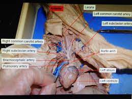 Imagequiz Fetal Pig Cardiovascular System