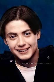 Remember when Dino Guevarra appeared in TGIS wearing braces then all of a  sudden lahat ng kabataan gusto na magka braces hahahaha his impact should  be studied