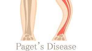 Maybe you would like to learn more about one of these? 12 Gangguan Dan Kelainan Sistem Rangka Manusia Gramedia Literasi