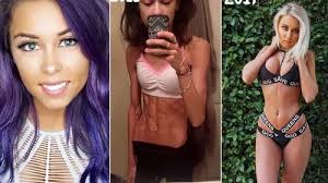 Anorexia sufferer who ate just 400 calories a day makes incredible  transformation after boyfriend's kind-hearted act