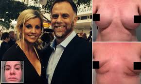 Mother fears she is dying after her 32E silicone implants poisoned her |  Daily Mail Online