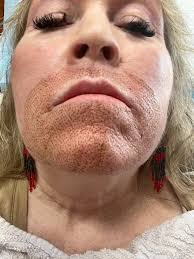 I use the collagen burn and I'm thinking of adding the detox…can I get  everyone's opinions?!