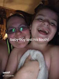 Barney's Milestone: Losing His First Tooth 🦷