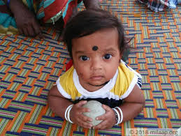 The ideal bath water temperature can vary from one infant to another. Their 7 Month Old Baby Fell Into Boiling Water And Is Fighting To Survive With 65 Of His Body Being Completely Burnt Milaap