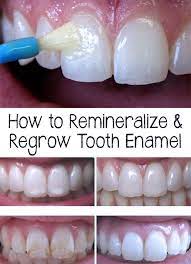 Amazing Did You Know That Tooth Enamel Represents The Toughest Structure Of The Body Find Out How To Remineralize And Teeth Health Tooth Enamel Dental Health