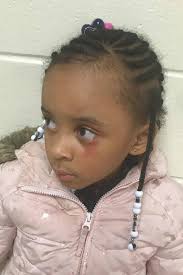 Mother fuming after five-year-old 'hit in face with a ruler by teacher'