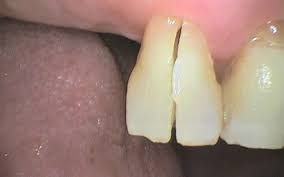 Dr jasmine cheong graduated from the university of melbourne with a bachelor of dental science with honours. Dentists Report A Wave Of Dental Problems Post Mco Free Malaysia Today Fmt