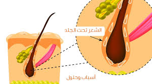 الشعر تحت الجلد أسباب عديدة وحلول ويب طب