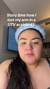 Chicken Wing Arm Utv Accident