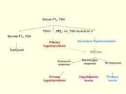 Hypothyroidism