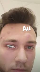 Siedmy diel série recast #live. Kauza Kolem Ondry Vlcka Nekonci Youtubera Udajne Zbil Starsi Bratr Jeho Trinactilete Pritelkyne Evropa 2
