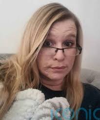 Mum felt “like a monster” and even hid her face from her daughter when she  was struck with cystic acne after having Covid