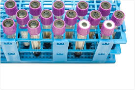 2 research institute for health sciences, faculty of medicine,. Vesicules Extracellulaires En Tant Que Biomarqueurs Flottants De Cancer