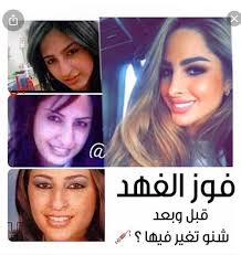 وبعد محو البيانات، لن تعمل خدمة العثور على جهازي على الهاتف. ÙÙˆØ² Ø§Ù„ÙÙ‡Ø¯ Ù‚Ø¨Ù„ Ø¹Ù…Ù„ÙŠØ§Øª Ø§Ù„ØªØ¬Ù…ÙŠÙ„