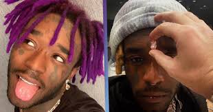 Lil uzi vert has revealed the new pink diamond he's embedded into his forehead costing $24 million. 60wa3 G2u1 L8m