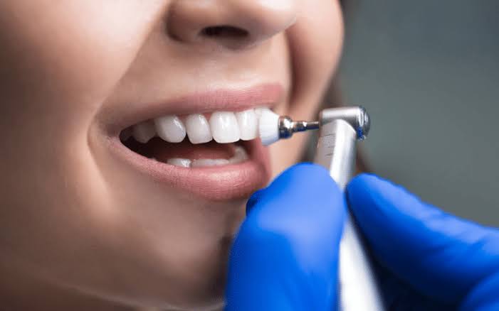 First Dental Cleaning Visit? Here's What To Expect