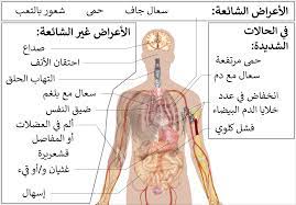 السعال وآلام العضلات وفقدان حاسة الشم والتذوق وسيلان الأنف. Ù…Ø±Ø¶ ÙÙŠØ±ÙˆØ³ ÙƒÙˆØ±ÙˆÙ†Ø§ 2019 ÙˆÙŠÙƒÙŠØ¨ÙŠØ¯ÙŠØ§