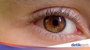 Arti kedutan lutut kanan depan. Tubuh Kedutan Dan Bergetar Pertanda Apa