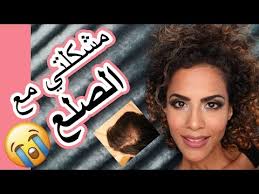 Rogaine علاج رهيب لتساقط الشعر Youtube