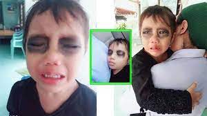 Kumpulan gambar mata animasi hitam putih untuk belajar mewarnai. Viral Cara Unik Ibu Hentikan Anaknya Yang Kecanduan Gadget Lukis Hitam Mata Sang Anak Saat Tidur Tribun Medan