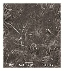 Image result for Phragmanthera capitata