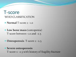 Bone Densitometry Ppt Download