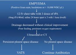 Loculated pleural effusion treatment guidelines. Treatment Of Empyema In Children Obgyn Key