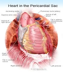 Image result for Pericarditis
